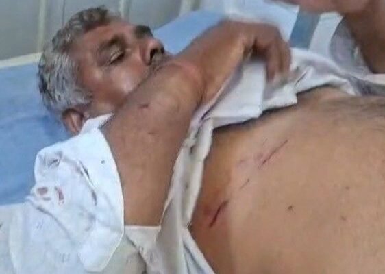 Dog attack: खेत में किसान पर कुत्ते का हमला, ग्रामीणों ने पीटकर मार डाला