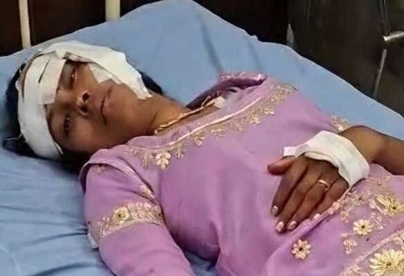 Accident: नीलगाय से टकराई बाइक, नवविवाहित दंपती गंभीर रूप से घायल