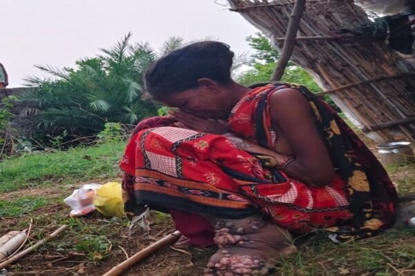 Disease: गरियाबंद में महिला को बीमारी के डर से गांव निकाला, अस्पताल में भर्ती