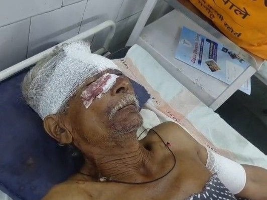 Leopard: पन्ना में खेत गए बुजुर्ग पर तेंदुए का हमला, हालत गंभीर