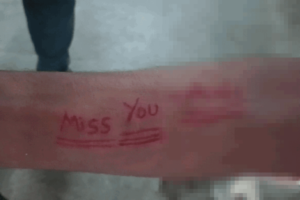 Rewa: नाबालिग ने हाथ पर लिखा Miss You, सुधार गृह में की आत्महत्या