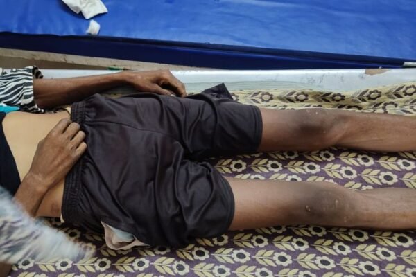 Anuppur: सोते समय करैत सांप के डसने से शख्स की मौत