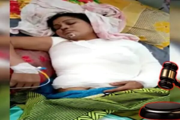 एमपी: भाभी को जिंदा जलाने वाले देवर को उम्रकैद, 3 साल बाद आया फैसला