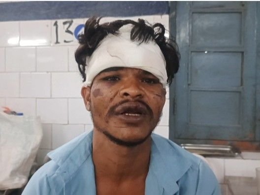 Panna: किलकिला कुंड में युवक पर जानलेवा हमला, पुरानी रंजिश में 5 ने पीटा