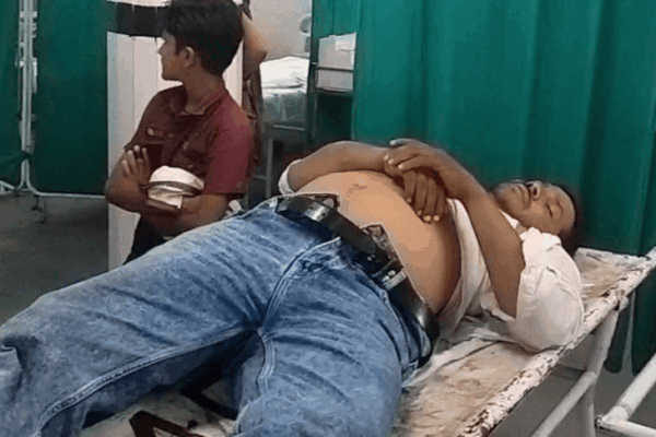 Tractor-trolley payment dispute: छतरपुर में युवक पर लाठी-डंडों से जानलेवा हमला