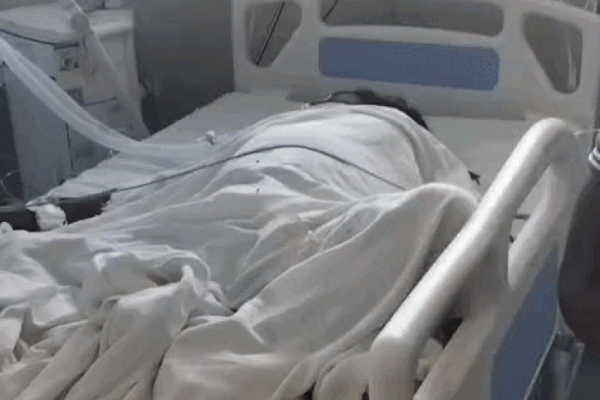 C-Section के बाद महिला की हालत गंभीर, बिगड़ी तबीयत के चलते निकालनी पड़ी बच्चेदानी
